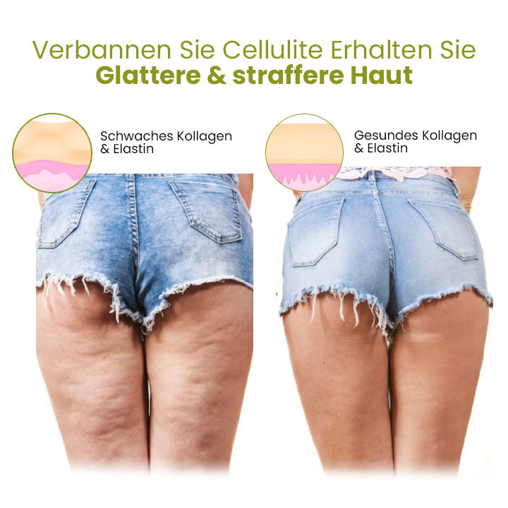 Monclara™ HerbalFirm - voor vermindering van cellulitis (60 STUKS!)